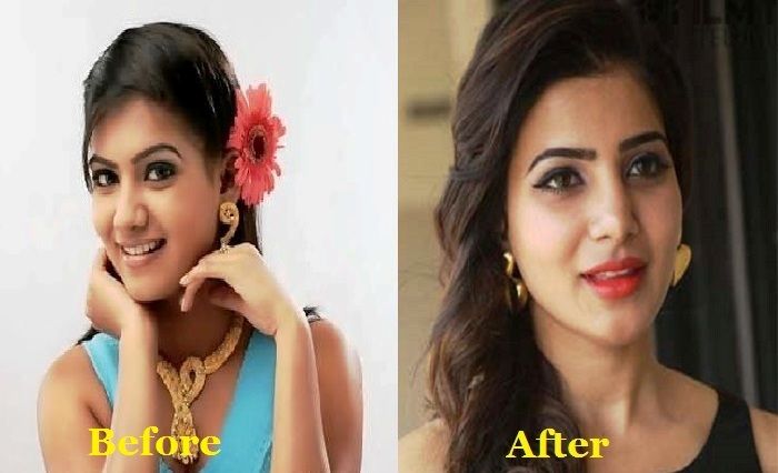 Samantha ruth prabhu plastic surgery - 🧡 Samantha-Ruth-Prabhu-2 -...