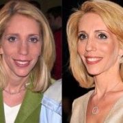 Dana Bash Height Feet Inches cm Weight Body Measurements