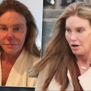 Caitlyn Jenner Height in cm Feet Inches Weight Body Measurements