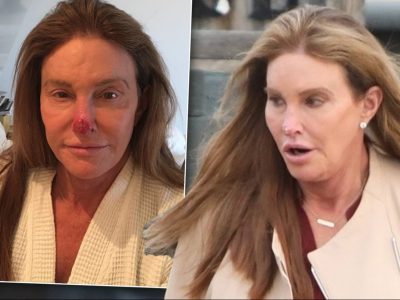 Caitlyn Jenner’s Height in cm, Feet and Inches – Weight and Body Measurements